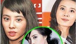 某整形医生爆料新闻视频,揭秘整形手术背后的真相